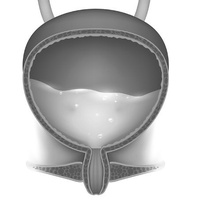 Нейрогенный мочевой пузырь