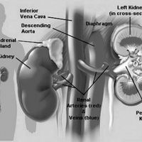 Терминальная стадия хронической почечной недостаточности
