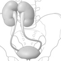Повреждения мочеточника