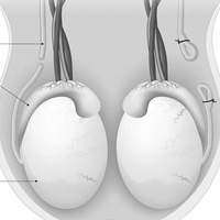 Вазэктомия