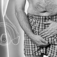 Мужские заболевания