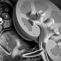 Коралловидные камни