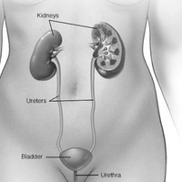 Заболевания мочевых путей у женщин