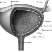 Повреждения мочевого пузыря