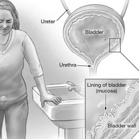 Воспаление и инфекции