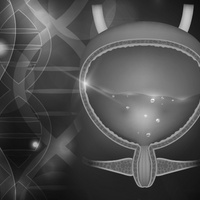 Экстрофия мочевого пузыря