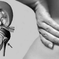 Цистиновый уролитиаз