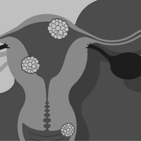 Гарднереллез