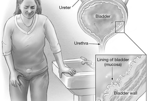 Воспаление и инфекции